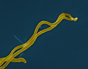 Borrelia burgdorferi bacteria, which can cause Lyme disease through the bite of an infected tick, is shown in gold color.