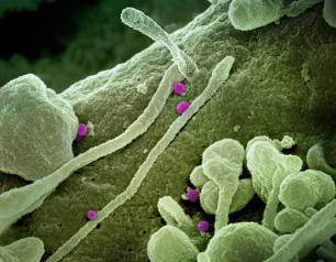 A scanning electron micrograph shows Crimean-Congo hemorrhagic fever viral particles in magenta budding from the surface of a patient’s cultured epithelial cells.