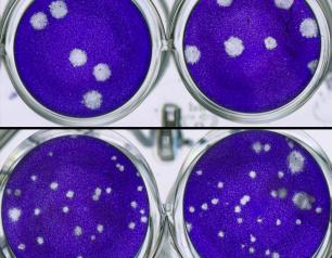 The top images, taken with a digital scanner, show La Crosse virus isolated from brain tissue of untreated mice growing in large plaques. The bottom images show restricted growth of virus isolated from mice treated with molnupiravir. 