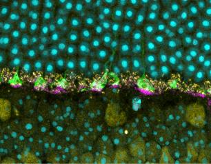 This image shows the outer layer of a mouse retina with normal prion protein visible at the base of photoreceptor terminals, called cone pedicles, which relay information about detected light to other retinal nerve cells and carry information to the brain to construct images.