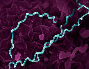  Several spiral-shaped bacteria have been highlighted in teal