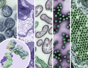 Five side by side images of different viruses.