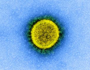 A transmission electron micrograph of a circular SARS-CoV-2 virus particle, colored yellow in this image