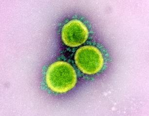 A transmission electron micrograph of three circular SARS-CoV-2 virus particles, colored green in this image, against a lilac background.