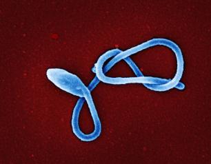 Snake-like blue Ebola virus particle on red background