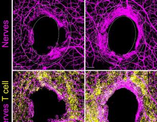 This confocal microscope image shows a ring of nerve regeneration occurring in mice (bottom right). Scientists exposed the mice to commensal bacteria (Staphylococcus aureus), then a month later the mice sustained an ear injury (biopsy). Ten days later the scientists took the image to document the nerve fiber recovery progress associated with immune cell responses (gold staining).