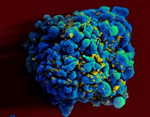 HIV infected H9 T cell