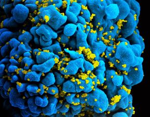 HIV-infected T cell