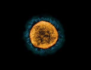 Transmission electron micrograph of a SARS-CoV-2 virus particle (UK B.1.1.7 variant)