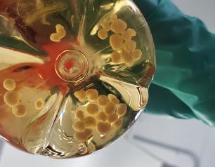 A researcher holds a glass flask containing small spherical human cerebral organoids similar to those used in the CWD study