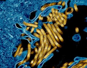 Microscopic view of gold, filament-shaped viruses clustered against a mass of blue tissue on a black background.  