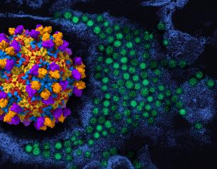 On the left is a 3D rendering of enterovirus D68 (viral proteins red, yellow, blue) with human monoclonal antibody EV68-228 (orange/purple). To the right in the background is a colorized transmission electron micrograph of enterovirus D68 virus particles (green).