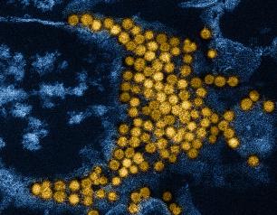 Yellow enterovirus particles and blue cells on a black-colored background.