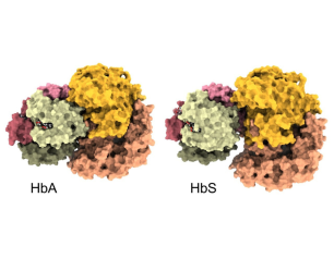 Two computer-generated images. Left is normal hemoglobin tightly connected to NOS enzyme. On right, mutated, sickle hemoglobin is not tightly connected to NOS enzyme.