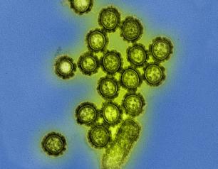 influenza virus particles, showing their round shape and bumpy surface proteins.