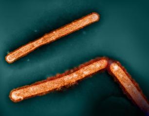 Colorized electron micrograph of three rod-shaped H5N1 virus particles.