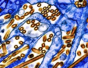 Yellow/red particles of avian influenza A H5N1 virus particles.