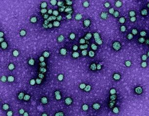 Microscopic image of dozens of teal-colored circular virus particles on a purple background.