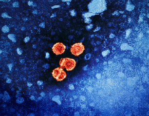 Image of Hepatitis B virus particles