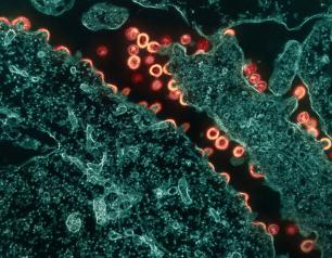 Pink and tan colored HIV-1 virus particles budding and replicating from a segment of a teal colored chronically infected H9 cell.