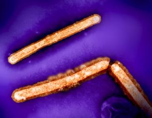 This image shows three influenza A (H5N1/bird flu) virus particles (rod-shaped; orange). 