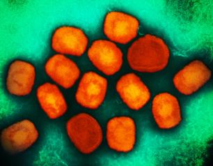 Monkeypox virus (orange circles) on green background.