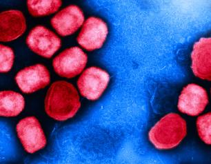 red circular monkeypox virus particles on a blue backdrop