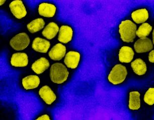 Electron micrograph of mpox virus particles (yellow) cultivated and purified from cell culture.