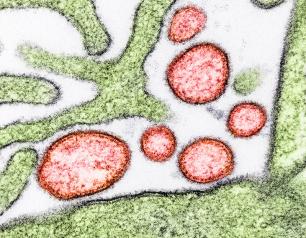 Colorized transmission electron micrograph of mature extracellular Nipah Virus particles (red) near the periphery of an infected VERO cell (green).