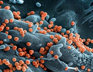 gray cell with orange spheres budding off