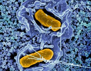 Scanning electron micrograph of Salmonella Typhimurium invading a human epithelial cell.