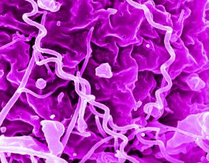 Image of syphilis bacteria