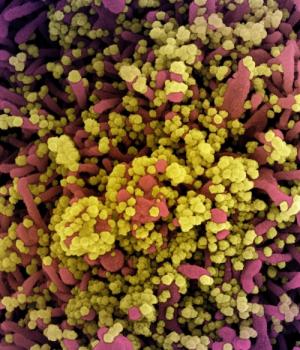Colorized scanning electron micrograph of a cell heavily infected with SARS-CoV-2 virus particles (yellow), isolated from a patient sample.