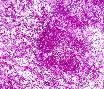 photo of candida albicans