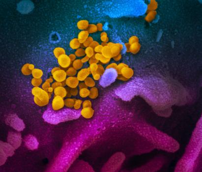 scanning electron microscope image of SARS-CoV-2