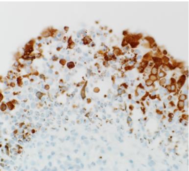 Replication of MERS-CoV in the cells lining the inside of the nose of dromedary camels