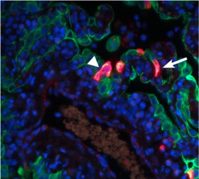 he red staining visualizes the replication of MERS-CoV in the alveoli, the arrowheads indicate type I pneumocytes, and the arrows indicate type II pneumocytes